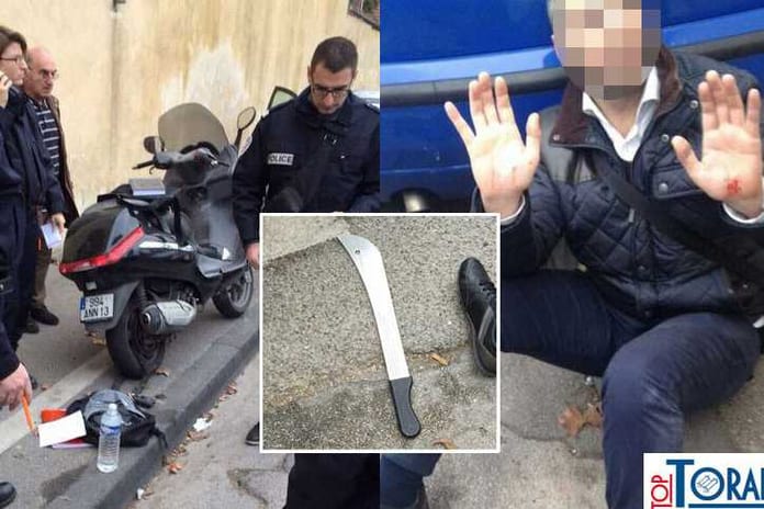 marseille-juif-machette-800x484_725_483