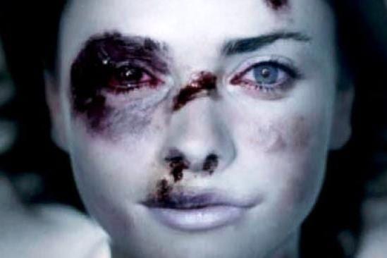 violence-a-l-egard-des-femmes-1