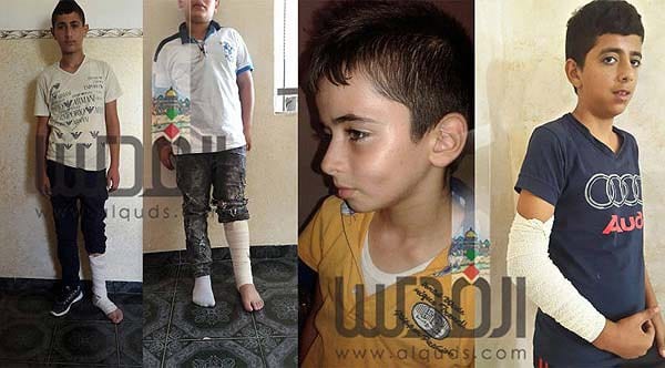 Injured-Palestinian-children