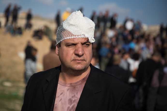 Ayman-Oudeh-bandage-HP_692_461