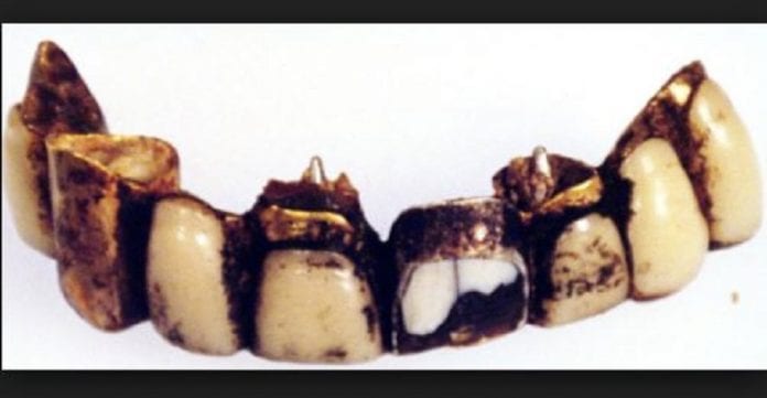 dentier-dhitler