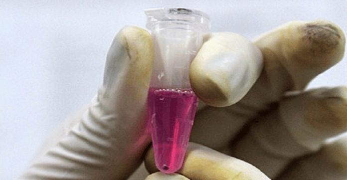 Test-pour-le-cancer-de-lovaire