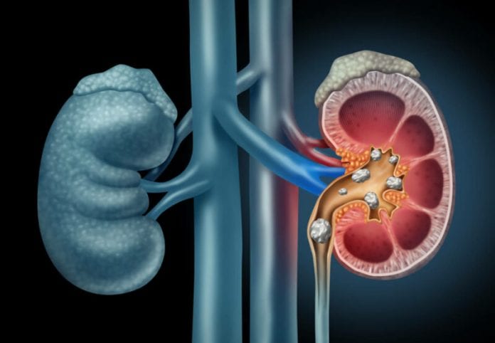 reins_calculs_paraplegie_ng_image_full-800x554