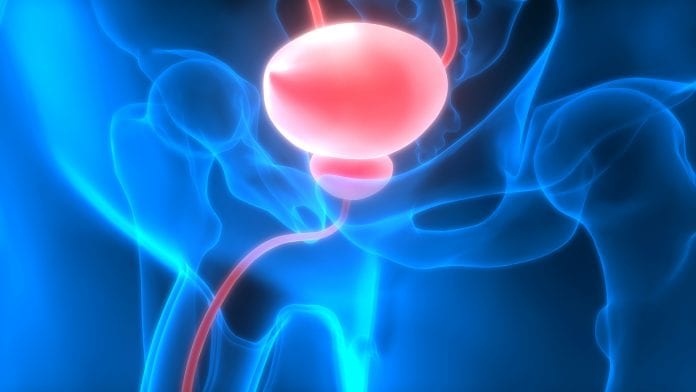cancer-vessie-Magic-mine-1920-shutterstock