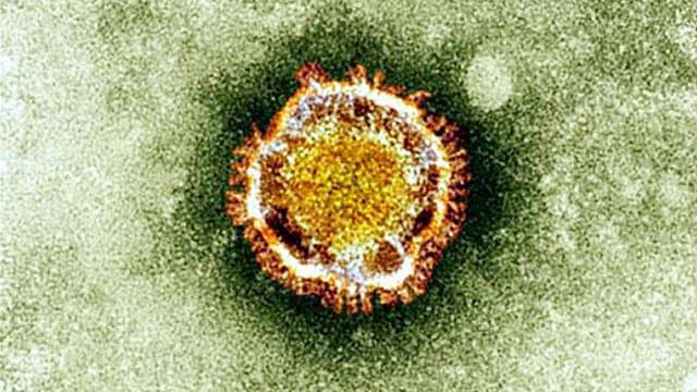 Le-coronavirus-vu-au-microscope-373230