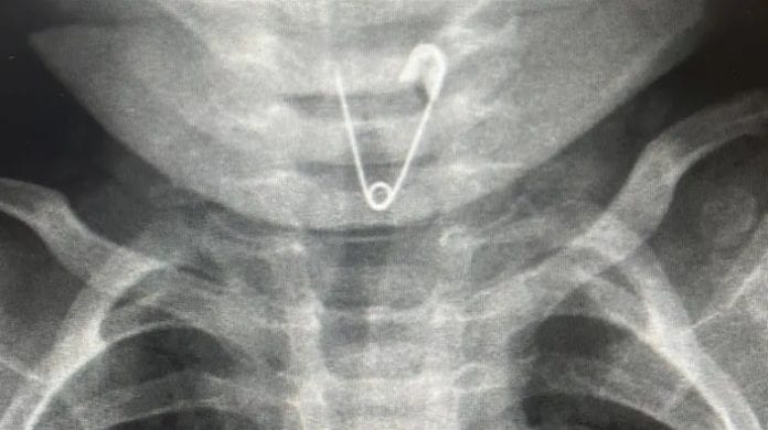The_surgery_that_saved