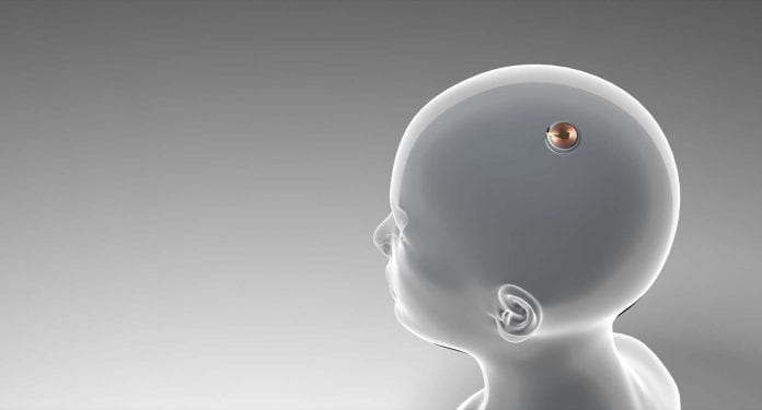 a61c6839b7_50184401_neuralink-implant-cerebral-elon-musk