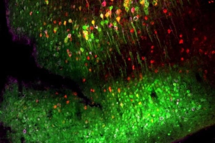 1.-α-synuclein-spread-in-the-mouse-brain.-1-1320x880