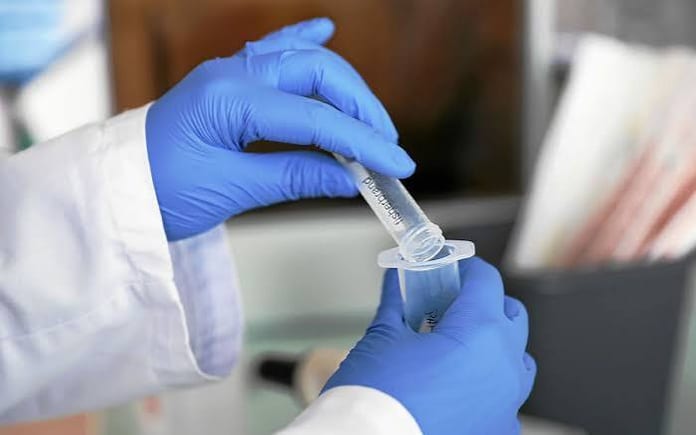 épidémies