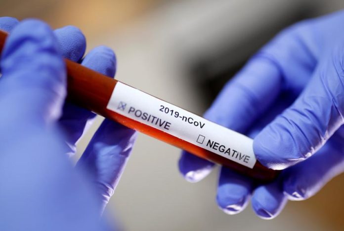 Coronavirus Lab Results REUTERS TT
