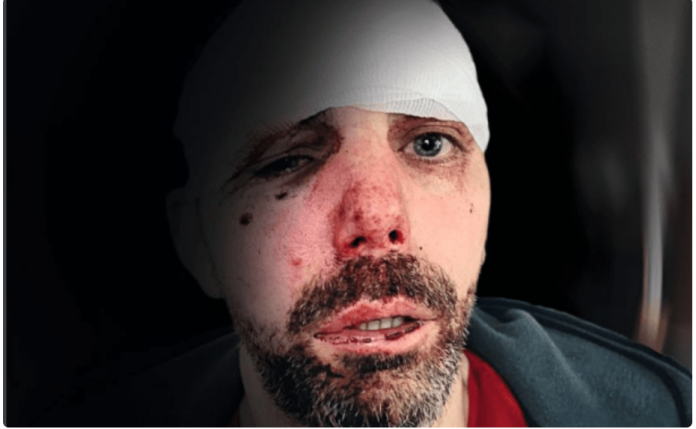 VA
